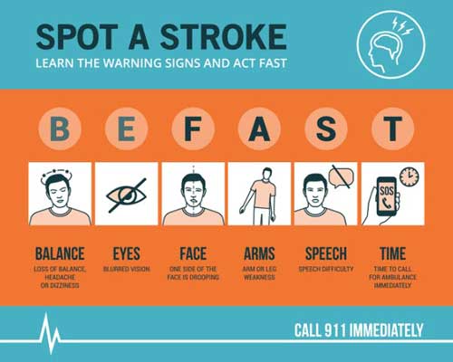 How to spot a stroke flyer